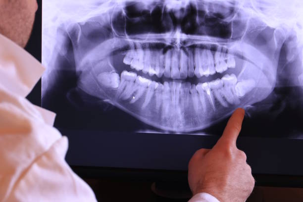 Best Emergency Dental Care for Broken or Chipped Teeth in Raymond, WA