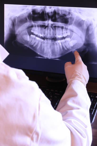Best Emergency Treatment for Dental Infections or Abscesses in Raymond, WA