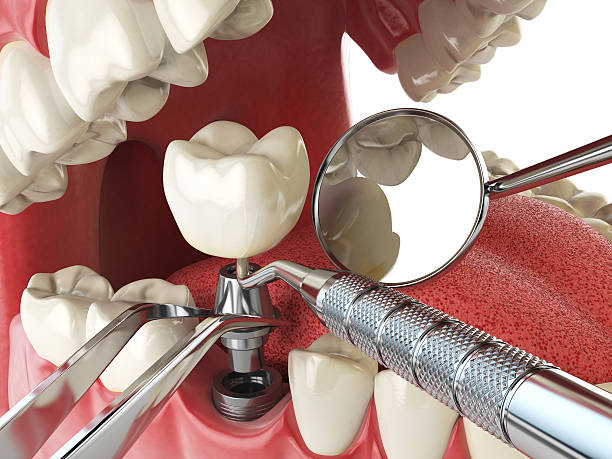 Best Emergency Gum Treatment in Raymond, WA
